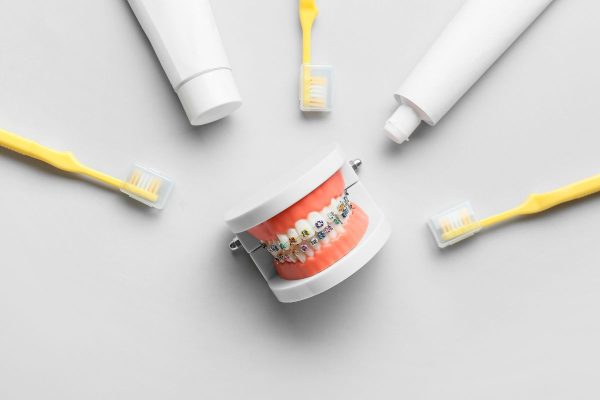 歯科矯正中の歯ブラシ