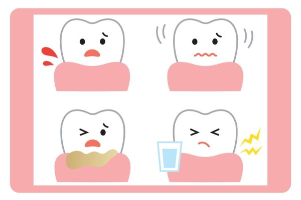 歯周病の状態