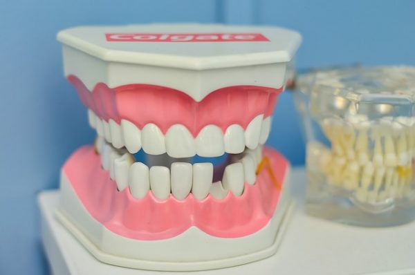 出っ歯に開咬…矯正治療をおすすめする悪い歯並び5種類