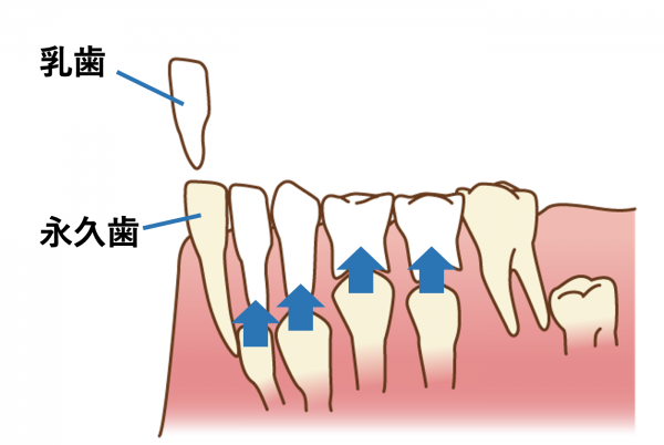 乳歯から永久歯への生え変わり