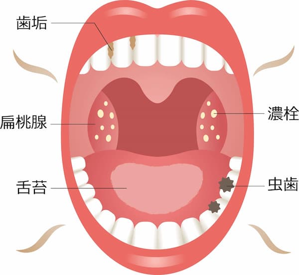 口臭ケア